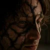 Dean Lewis - Poison